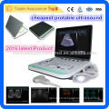 MSLPU34-I 2016 Latest PC base cheapest portable ultrasound machine/3d ultrasound scanner portable laptop